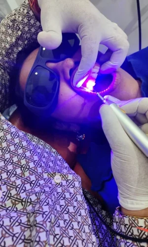 Laser-Dentistry-2-768x1024